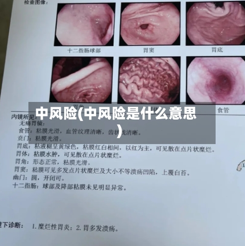 中风险(中风险是什么意思)
