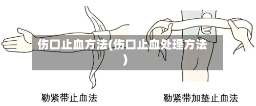 伤口止血方法(伤口止血处理方法)-第3张图片