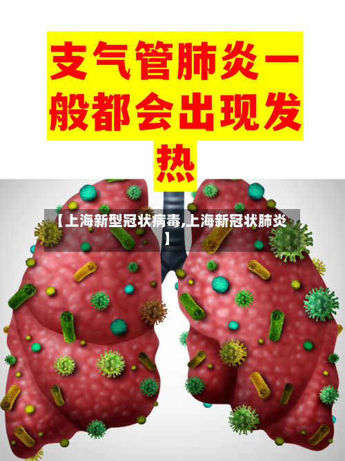 【上海新型冠状病毒,上海新冠状肺炎】-第2张图片